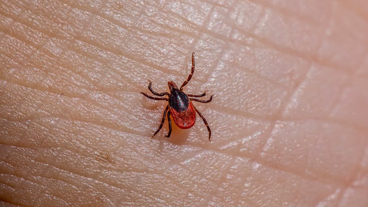 Detailed macro shot of a Castor Bean Tick (Ixodes ricinus) on human skin.